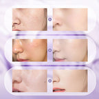 🎉2025 New Upgrade🎉All-in-One Niacinamide Cream