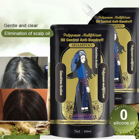 🎁Last Day Promotion 49% Off🔥Ginger Plant Extract Anti-Hair Loss Hair Shampoo