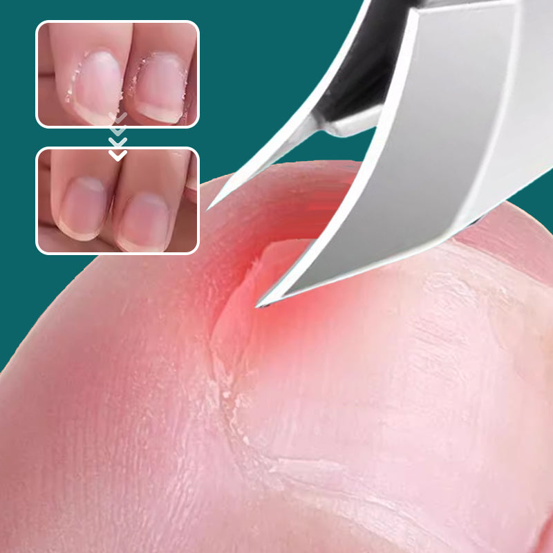 🔥 Anti-Splash 25° Slant Edge Nail Clipper 3-Piece Set